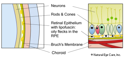 Stargardt diagram